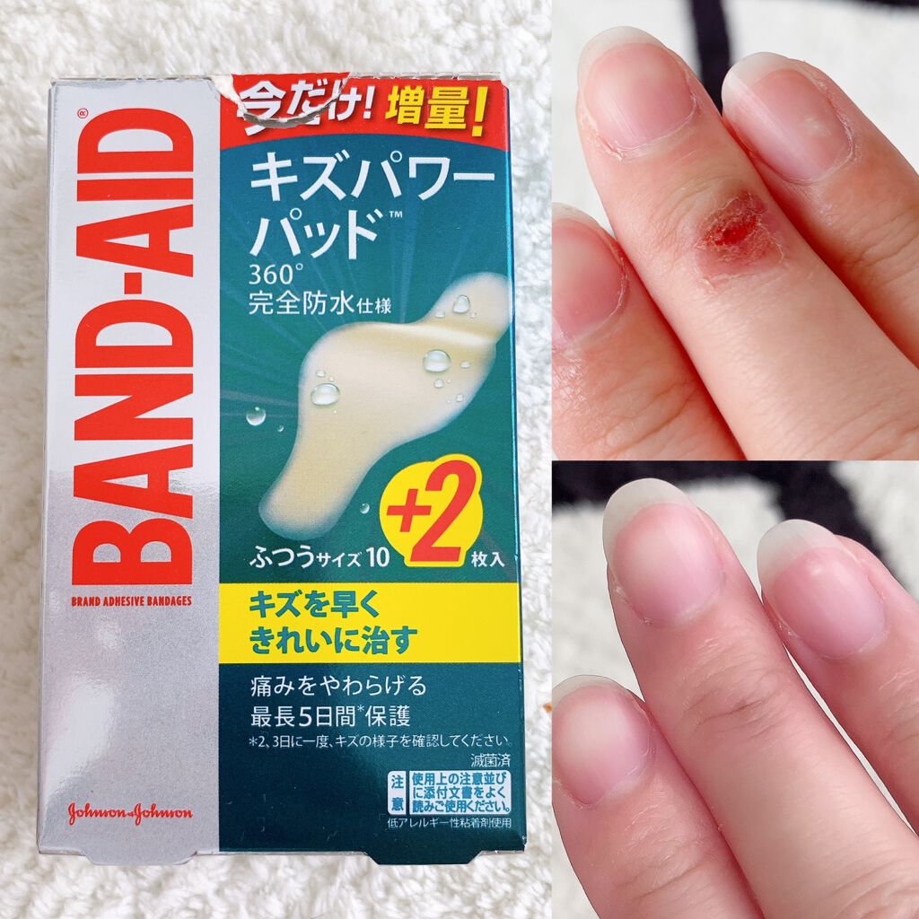 キズパワーパッド/バンドエイド/その他を使ったクチコミ(1枚目)