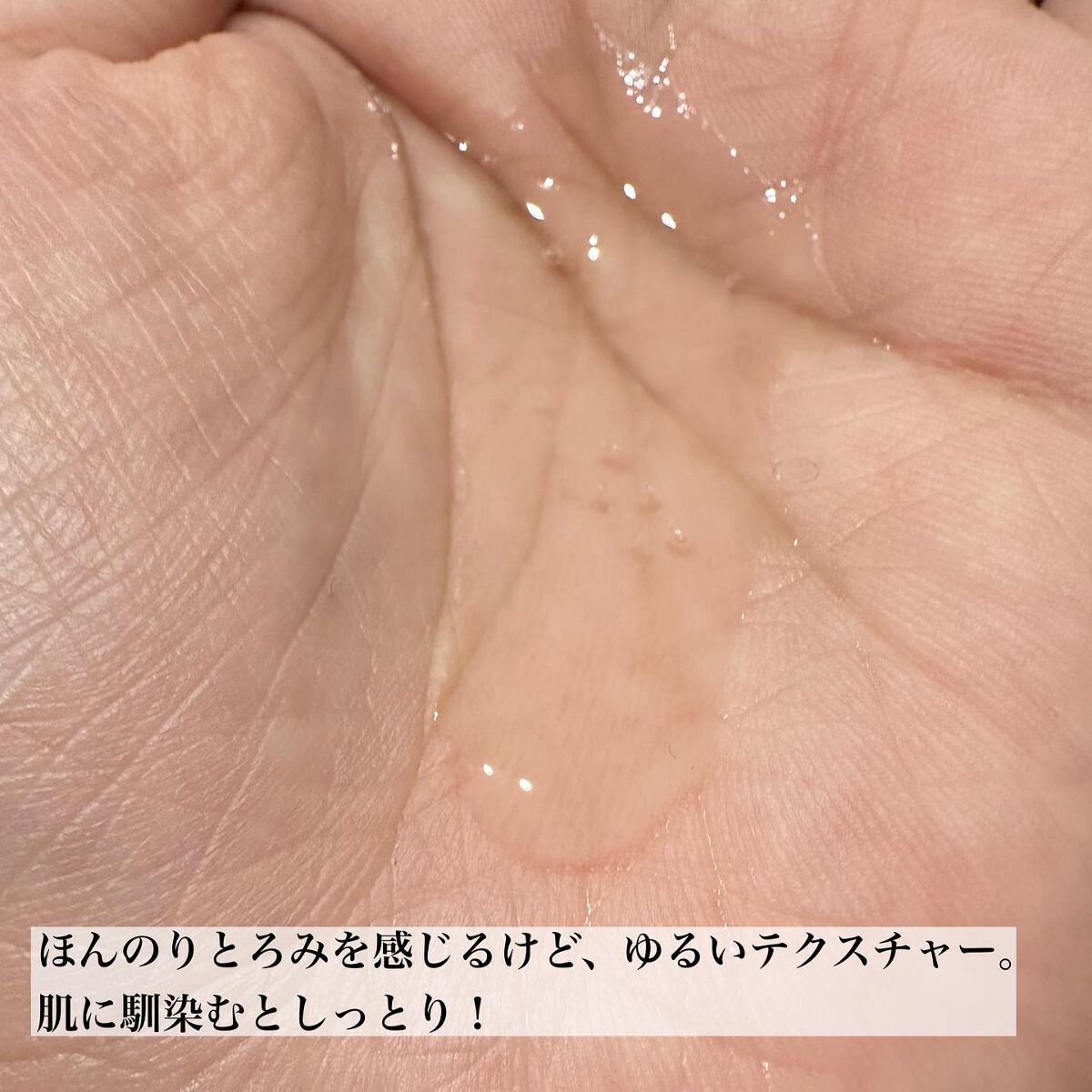 薬用マイクロバブルローション/Macchia Label/化粧水を使ったクチコミ(5枚目)