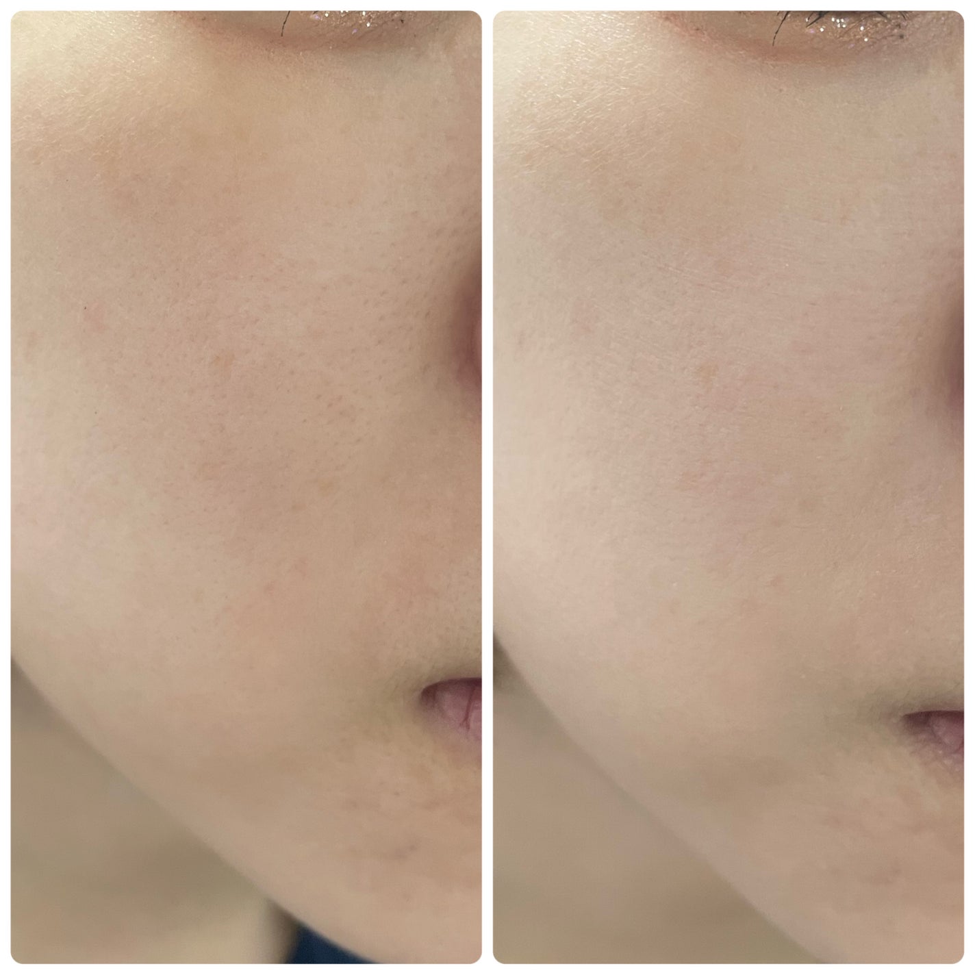 トーンステインカラーコレクティングプライマー/VDL/化粧下地を使ったクチコミ(3枚目)