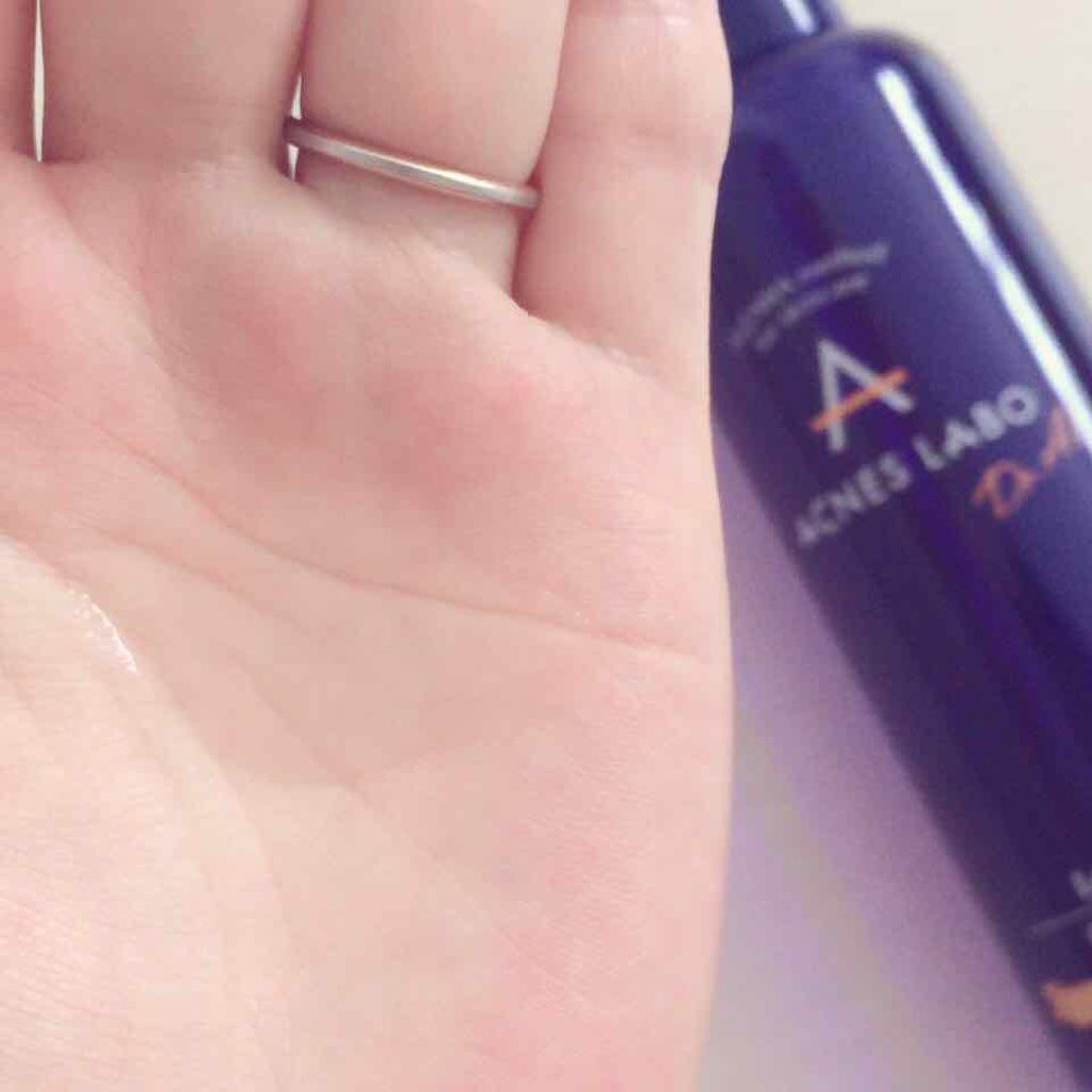 アクネスラボ 薬用 ローションのクチコミ「#アクネスラボ 様より
お試しさせていただきました！

#薬用ニキビケアローション

皮脂のバ.....」（3枚目）