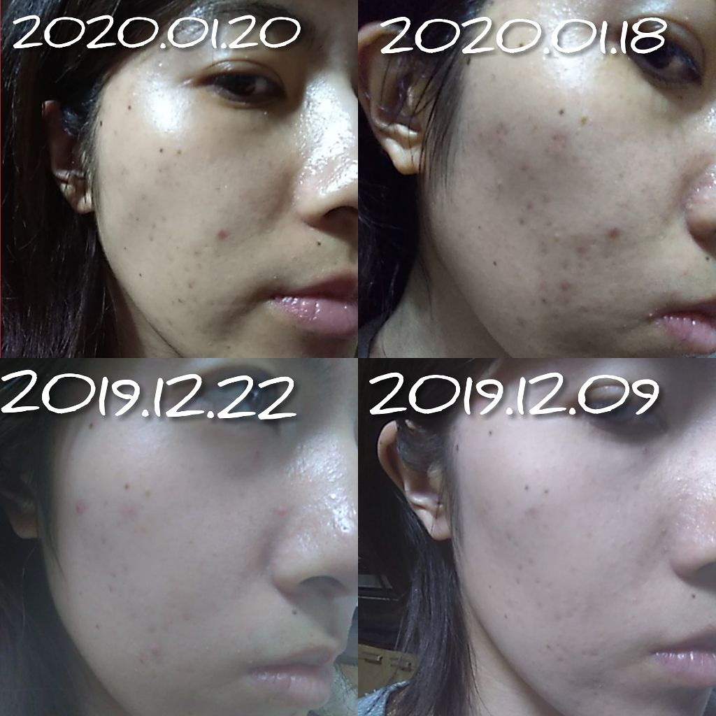 プレミアム フレッシュマスク(透明感)/クリアターン/シートマスク・パックを使ったクチコミ（1枚目）