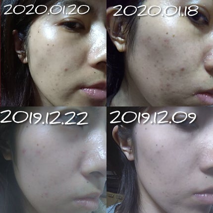 プレミアム フレッシュマスク(透明感)/クリアターン/シートマスク・パックを使ったクチコミ(1枚目)