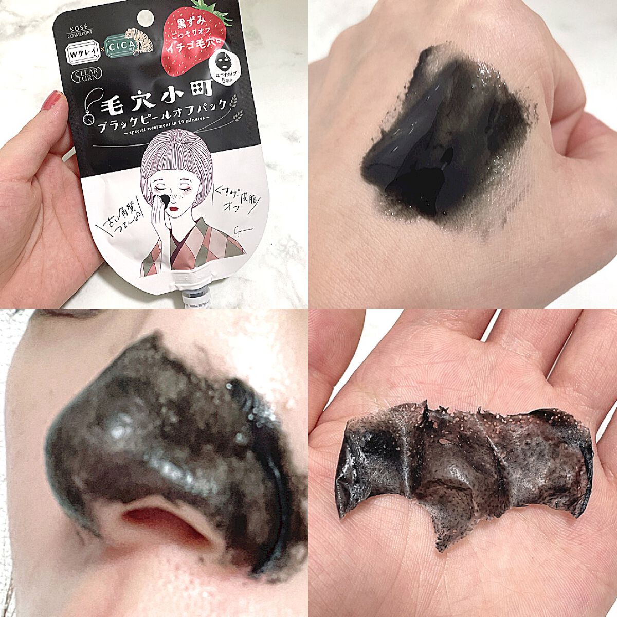 毛穴小町 イエローピールオフパック/クリアターン/ピーリングを使ったクチコミ（2枚目）