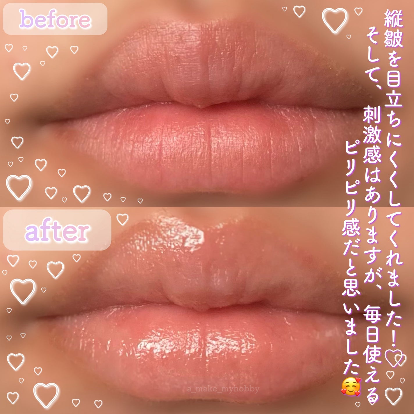 ナイトニードルリップ/CHOOSY/リップ美容液を使ったクチコミ(4枚目)