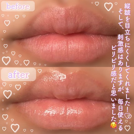 ナイトニードルリップ/CHOOSY/リップ美容液を使ったクチコミ(4枚目)