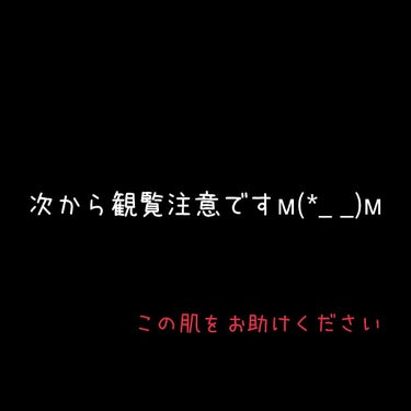 いきなり目障りなものをお見せしてすいませんm(*_ _)m

私は、高校1年生です。
こんな肌じゃ華のJK!!なんて喜んでられませんよね..。
私は小学五年生くらいから胸元にブツブツが出来ていました。そ