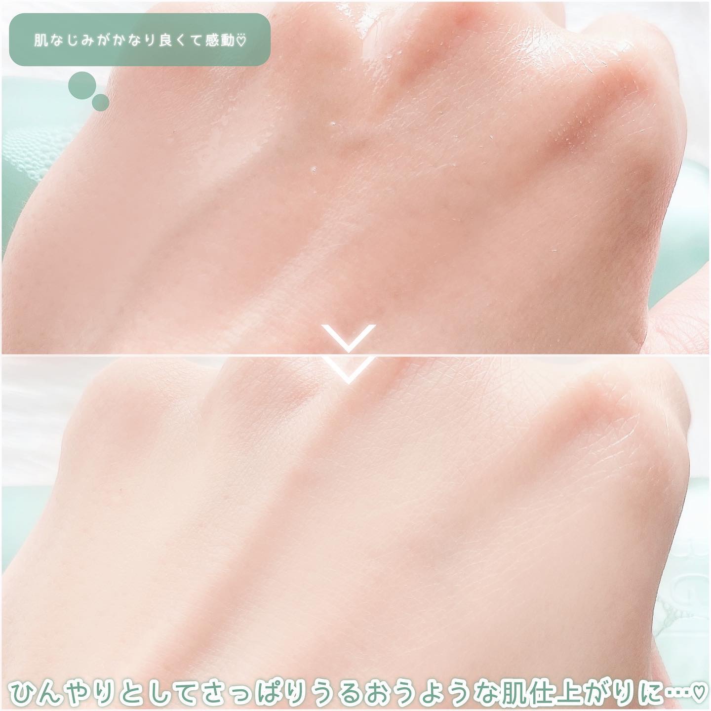 ティーツリーシカスージングトナー/BRING GREEN/化粧水を使ったクチコミ（3枚目）