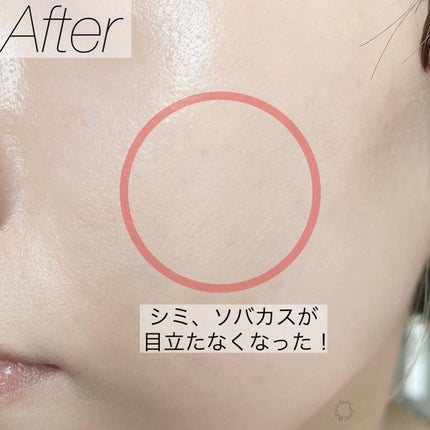 パーフェクトカバー コンシーラーパレット/Dear.A/パレットコンシーラーを使ったクチコミ(7枚目)