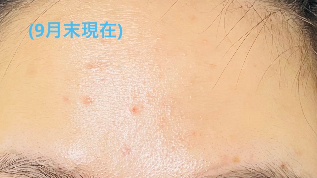 グルタ ビタミンC トーニング アンプル/IOPE/美容液を使ったクチコミ(4枚目)