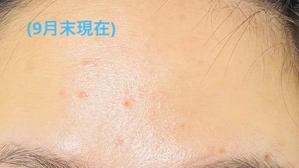 グルタ ビタミンC トーニング アンプル/IOPE/美容液を使ったクチコミ(4枚目)