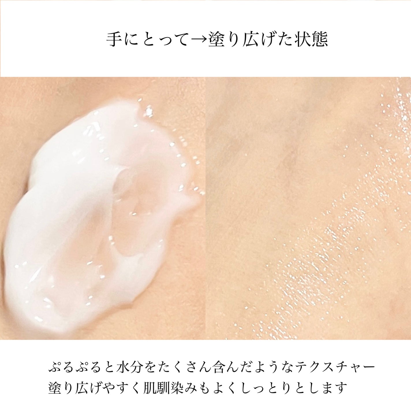 レッドブレミッシュ クリアモイスチャークリーム/Dr.G/フェイスクリームを使ったクチコミ(2枚目)