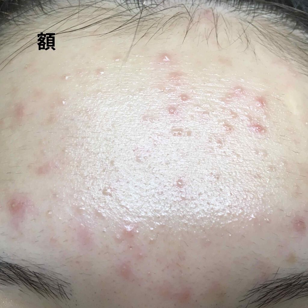 ハトムギ化粧水(ナチュリエ スキンコンディショナー R )/ナチュリエ/化粧水を使ったクチコミ(4枚目)