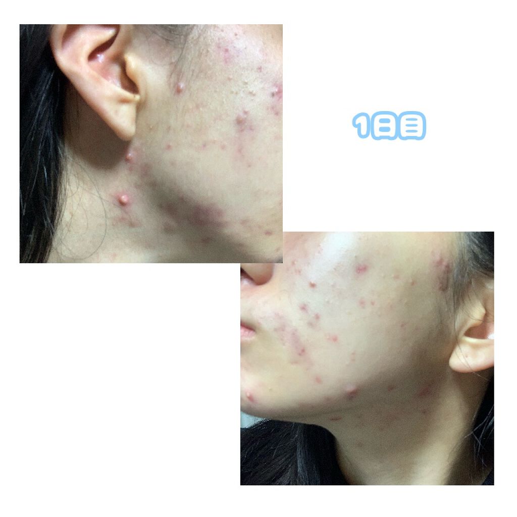 敏感肌用薬用美白美容液/無印良品/美容液を使ったクチコミ（2枚目）