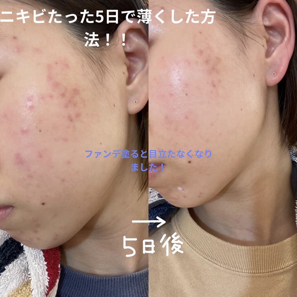 を使ったクチコミ（1枚目）