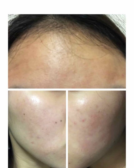 ハトムギ化粧水(ナチュリエ スキンコンディショナー R )/ナチュリエ/化粧水を使ったクチコミ(1枚目)