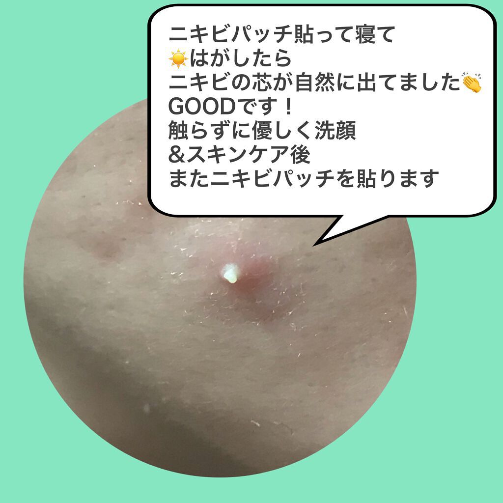 LA10+HAフェイスセラム/The Ordinary/ピーリングを使ったクチコミ（2枚目）