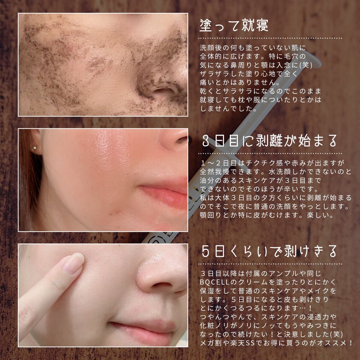 ダーマスキンピーリング/BQCELL/その他キットセットを使ったクチコミ(3枚目)