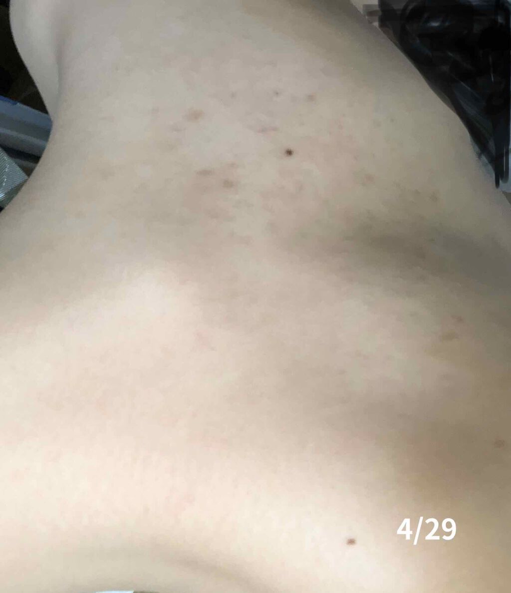 EclatCharme(エクラシャルム)/FABIUS/オールインワン化粧品を使ったクチコミ(4枚目)