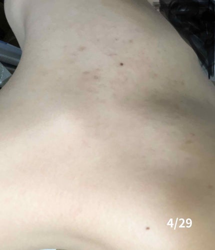 EclatCharme(エクラシャルム)/FABIUS/オールインワン化粧品を使ったクチコミ(4枚目)