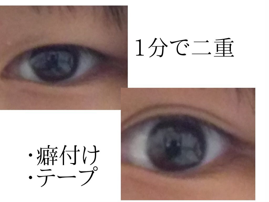しなやかフィット/DAISO/二重まぶた用アイテムを使ったクチコミ(1枚目)
