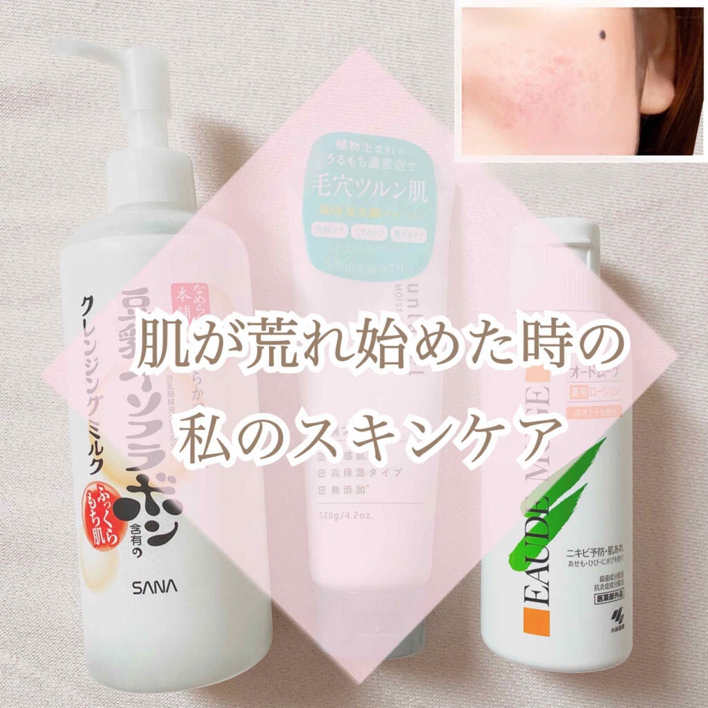 オードムーゲ 薬用ローション(ふきとり化粧水)/オードムーゲ/拭き取り化粧水を使ったクチコミ(1枚目)