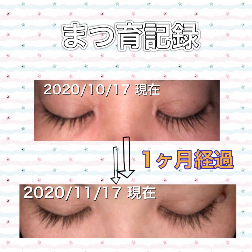 スカルプD ボーテ ピュアフリーアイラッシュセラム プレミアム/アンファー(スカルプD)/まつげ美容液を使ったクチコミ(1枚目)