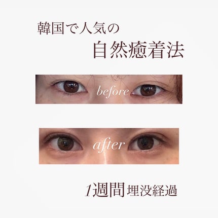 アイトーク/アイトーク/二重まぶた用アイテムを使ったクチコミ(1枚目)