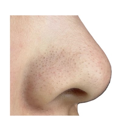 ノーモアブラックヘッド(ノーズピーリング)/One-day's you/スクラブ・ゴマージュを使ったクチコミ(4枚目)