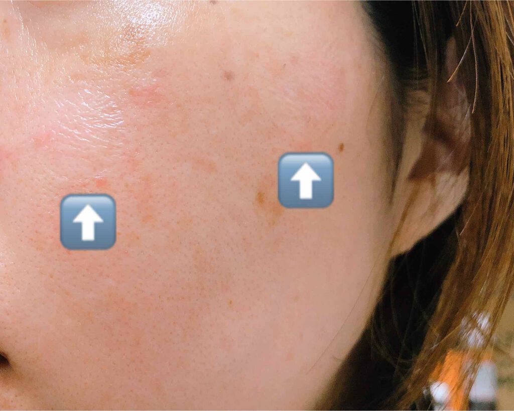 pipi on LIPS 「インスタでたまたま見かけたUVブロックフィルム#FILMOR*..」(4枚目)