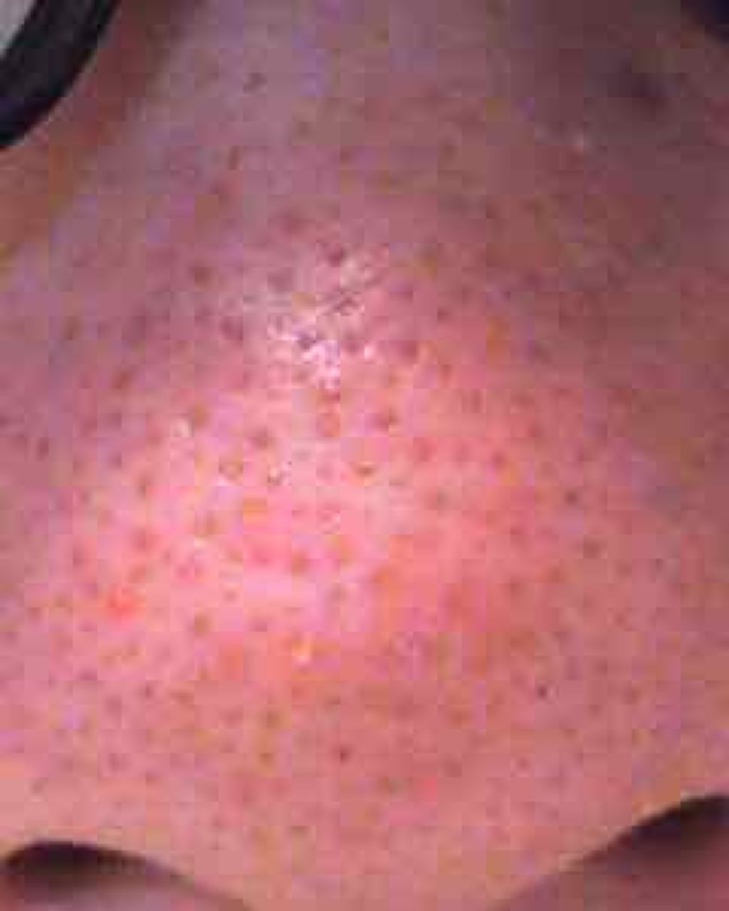 重曹スクラブ洗顔/毛穴撫子/スクラブ・ゴマージュを使ったクチコミ(2枚目)