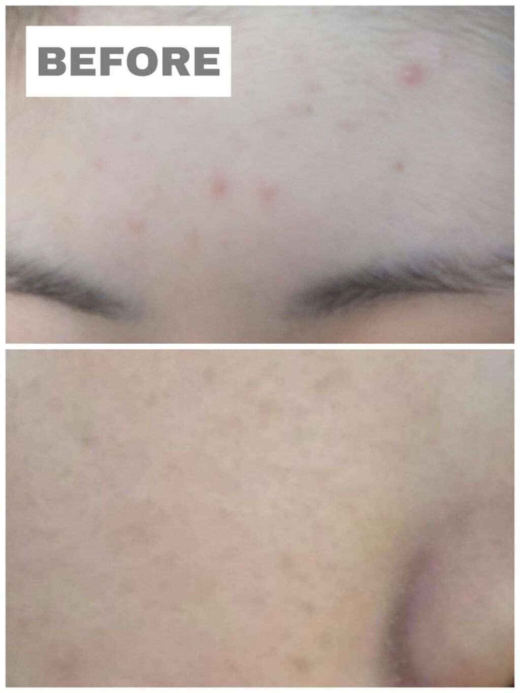 白潤プレミアム薬用浸透美白化粧水/肌ラボ/化粧水を使ったクチコミ（3枚目）