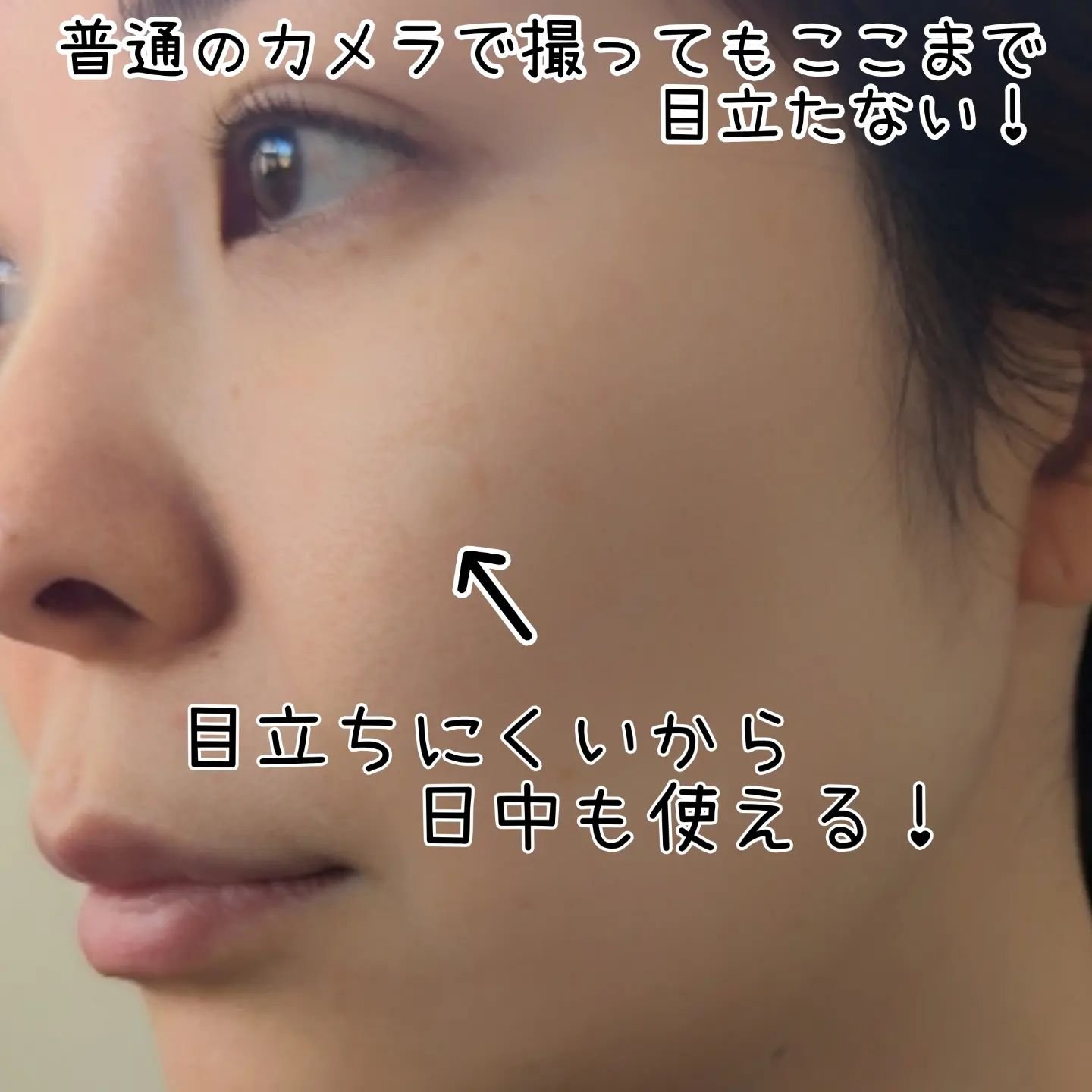 キャッチミーパッチ/CATCH ME PATCH/にきびパッチを使ったクチコミ（2枚目）