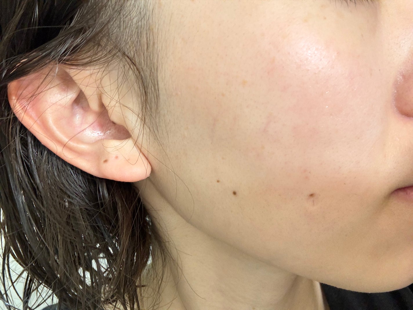 ピュアバブルローション/Cure/化粧水を使ったクチコミ(3枚目)