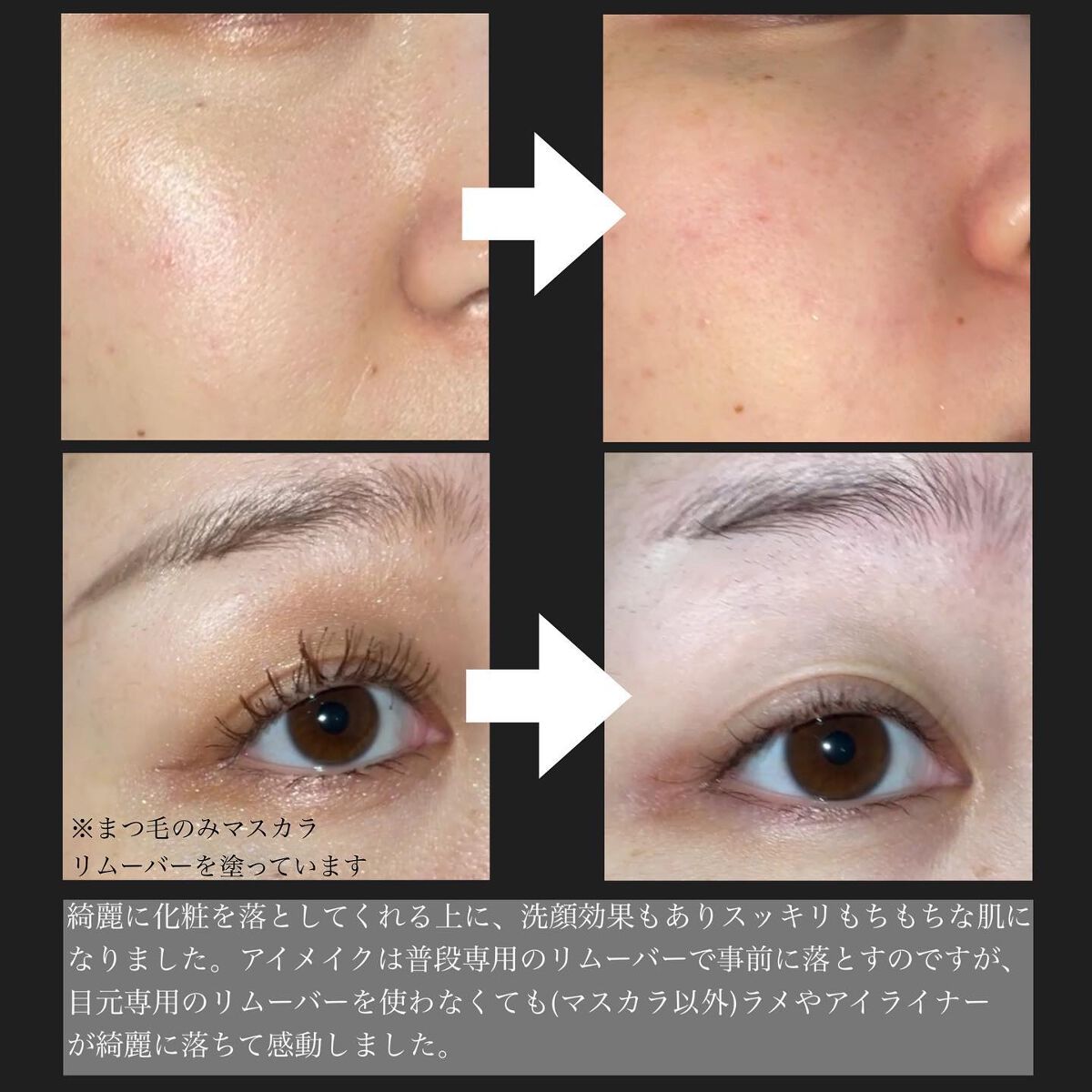 ブラックジェルクレンジング/.akaran/クレンジングジェルを使ったクチコミ(3枚目)