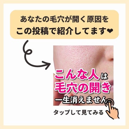 あなたの肌に合ったスキンケア💐コーくん先生 on LIPS 「【マジでヤバい。】爪が凹んでる人は危険です🚨.
.
あなたの毛..」(9枚目)