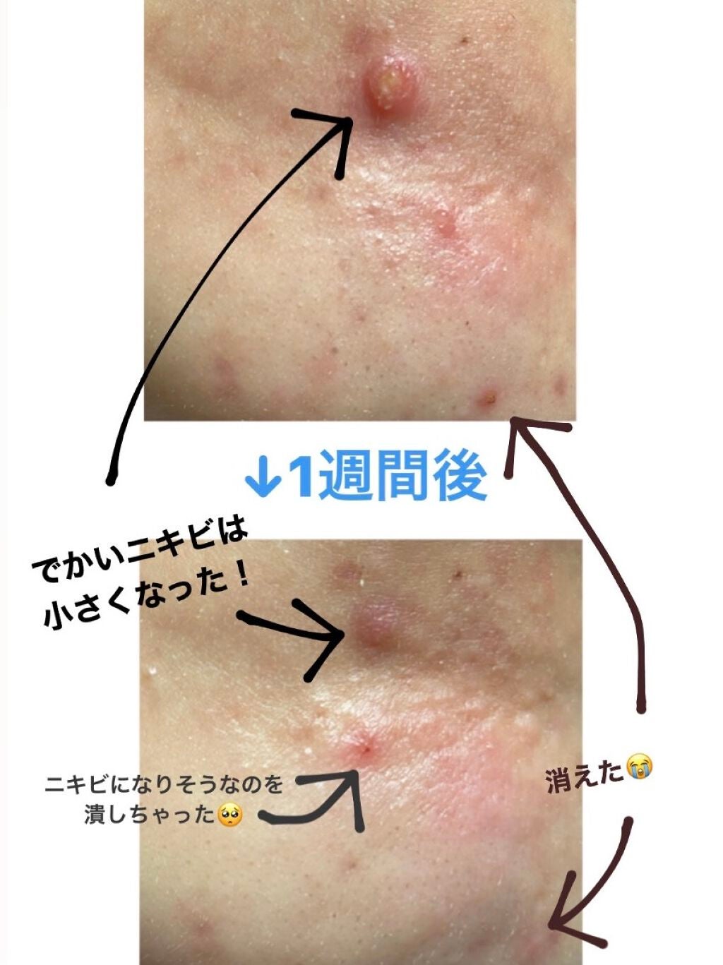 クリアトライアルセット M(しっとりタイプ)/オルビス/トライアルキットを使ったクチコミ(2枚目)