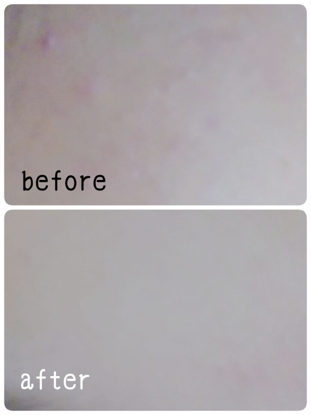 薬用アクネモイストジェル/DAISO/フェイスクリームを使ったクチコミ（2枚目）