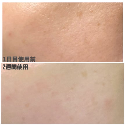 ヘデラヘリックス デイリー&クイック スージングマスク/Milk Touch/シートマスク・パックを使ったクチコミ(5枚目)