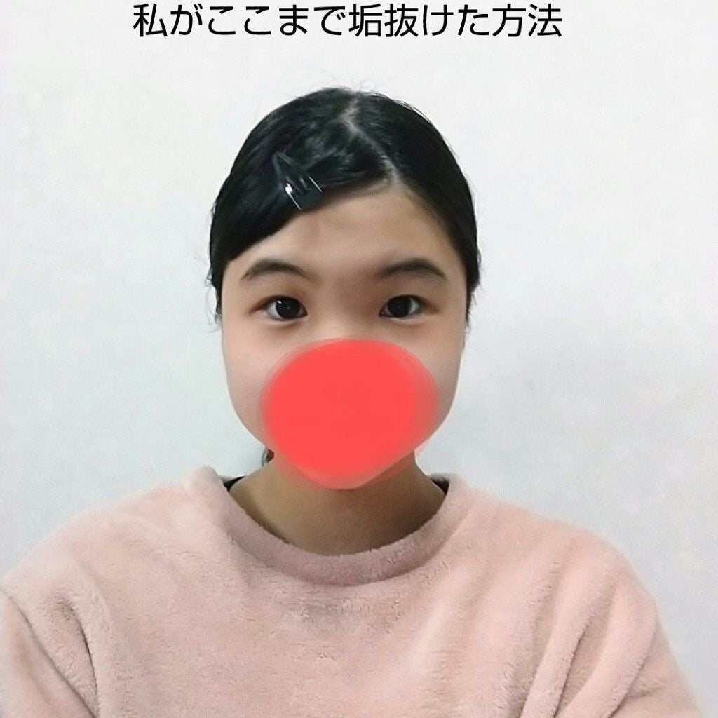 ❁ゆいな❁ on LIPS 「皆さんこんにちはゆいです!!今回は、私がここまで垢抜けた方法に..」(1枚目)