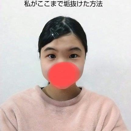 ❁ゆいな❁ on LIPS 「皆さんこんにちはゆいです!!今回は、私がここまで垢抜けた方法に..」(1枚目)