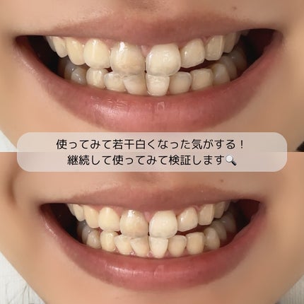 ホワイトパープル歯みがき ピーチフローラルミントの香り/EUTHYMOL/歯磨き粉を使ったクチコミ(4枚目)