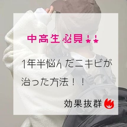 薬用アクネレスソープ/ドクターシーラボⓇ/洗顔石鹸を使ったクチコミ(1枚目)
