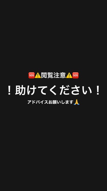 KISO スーパーリンクルセラムVAのクチコミ「アドバイスお願いします🙏🙏
ニキビが全然治りません。
ほんとに毎日鏡を見るのが嫌で自分の顔.....」（1枚目）