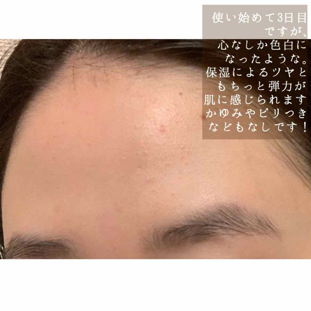 塗る米ぬか化粧水/米一途/化粧水を使ったクチコミ(4枚目)