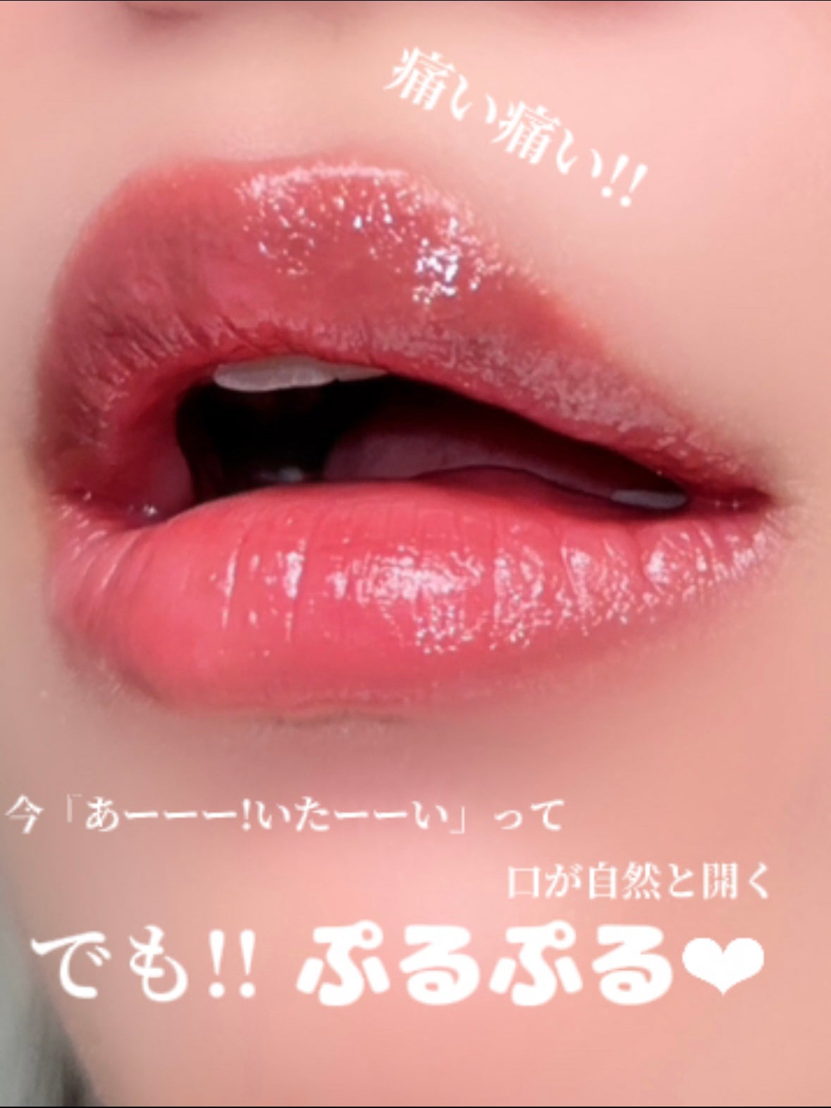 ドトムリッププラスプランパー/keybo/リッププランパーを使ったクチコミ(2枚目)