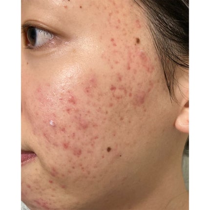 プロポリス エネルギーアンプル/CNP Laboratory/美容液を使ったクチコミ(1枚目)