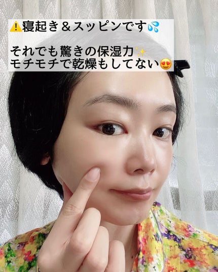 デュイセル シカプラスバーム/DEWYCEL/フェイスクリームを使ったクチコミ(5枚目)