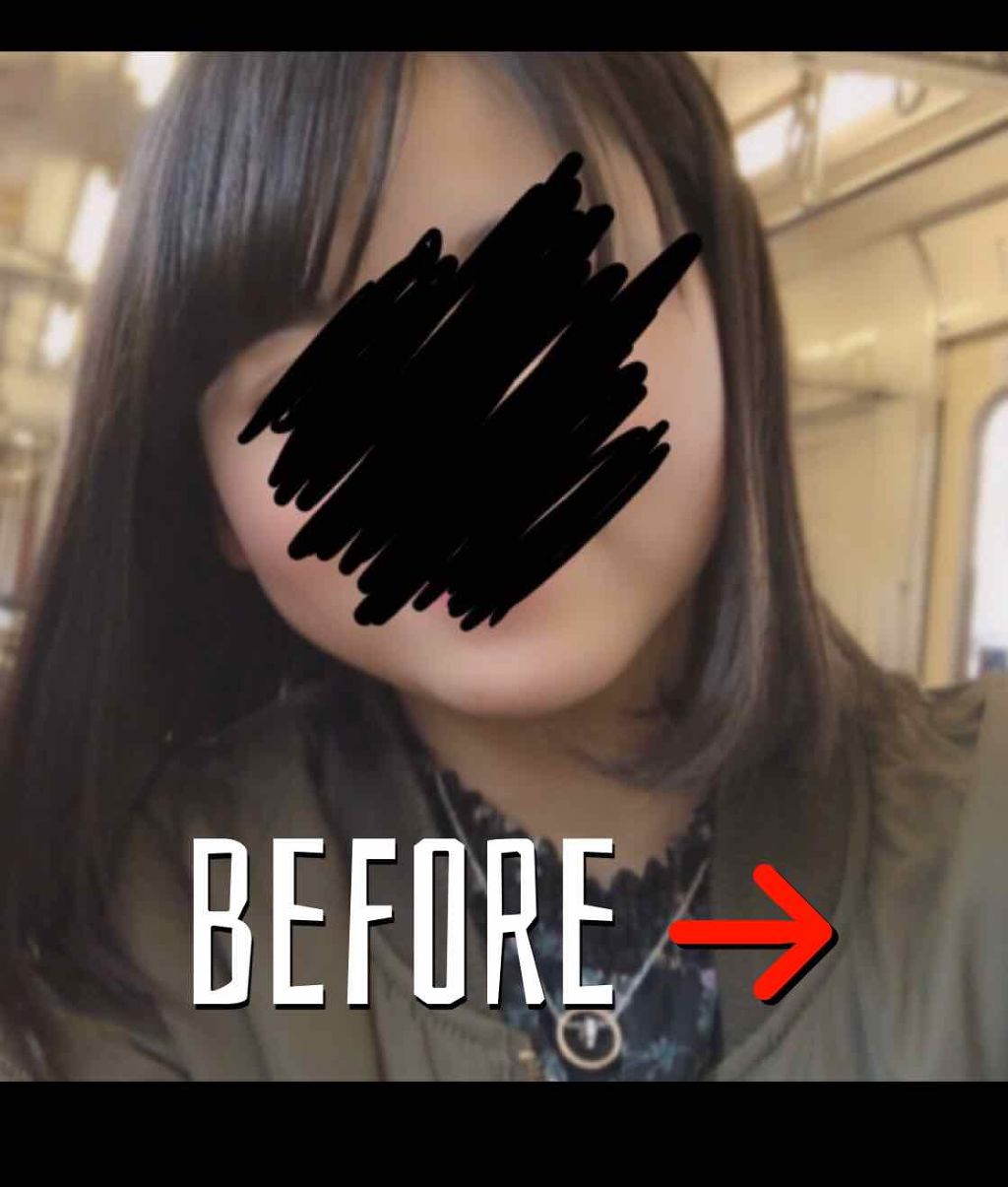 ハトムギ化粧水(ナチュリエ スキンコンディショナー R )/ナチュリエ/化粧水を使ったクチコミ(2枚目)