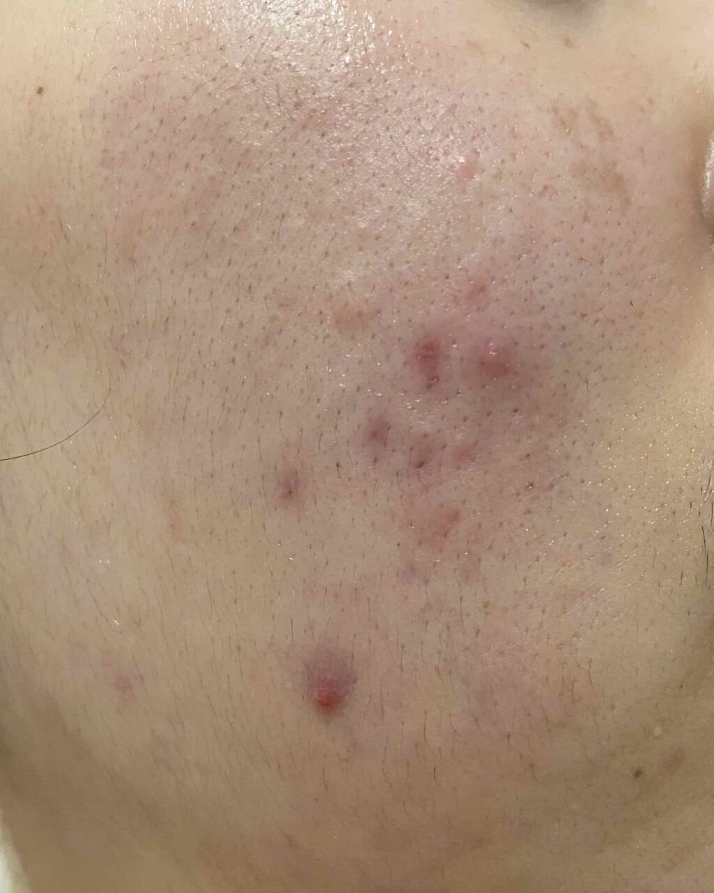 Cセラム/b.glen/美容液を使ったクチコミ(2枚目)