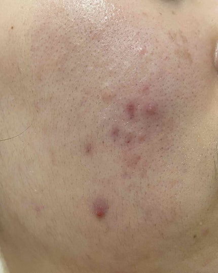 Cセラム/b.glen/美容液を使ったクチコミ(2枚目)